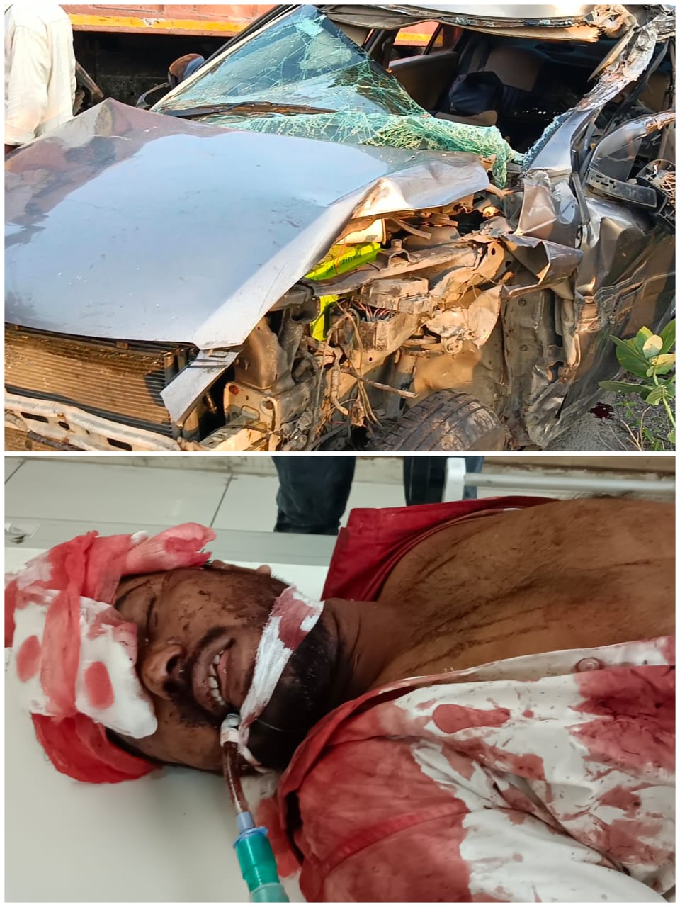 उत्तराखंड हल्द्वानी: ट्रेचिंग ग्राउंड के निकट भीषण सड़क हादसे में तीन घायल, एक गंभीर