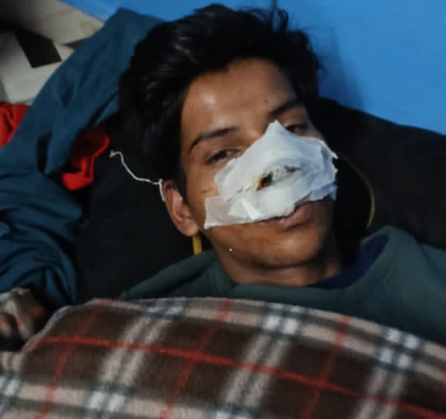 दुकान के सामने स्कूटी खड़ी करने को लेकर हुआ विवाद, युवक को चाकू से गोंदा…..